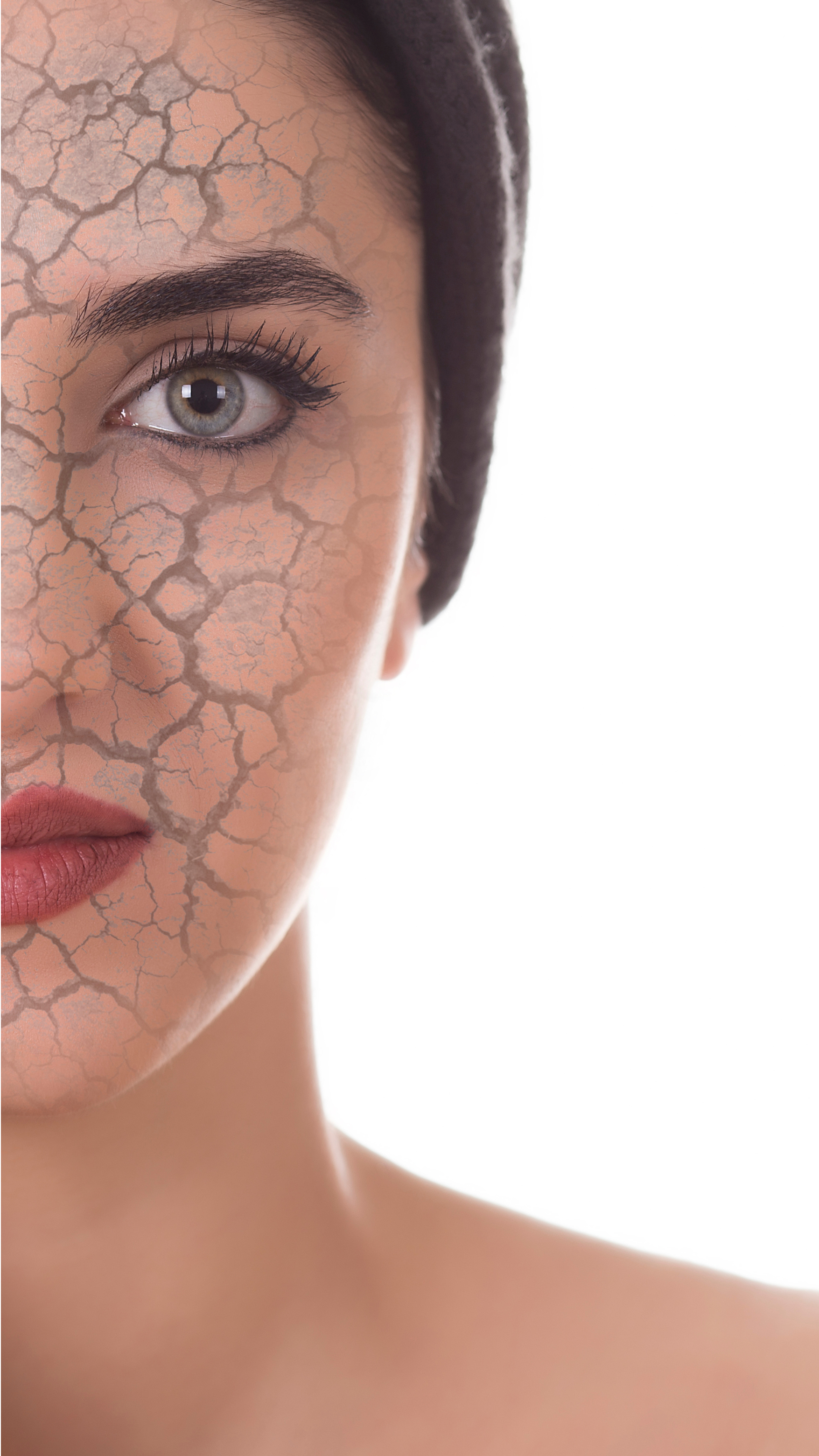 Dull Dry skin